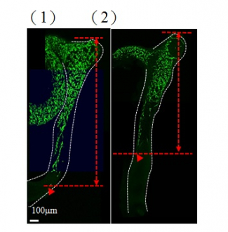 圖中，染有綠色是在腸道的神經元細胞。1)正常小鼠，在胚胎發育較早時期，大部份腸道已被神經元細胞覆蓋並形成腸道神經網。2)如小鼠帶有異常的GLI蛋白，神經網覆蓋範圍大大減少，情況與患有先天性巨結腸症病人的腸道相似。紅線顯示神經網覆蓋範圍。